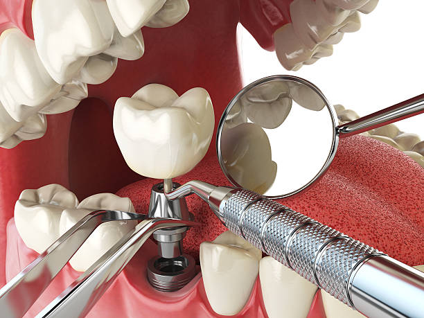 Best Emergency Root Canal Treatment in Shannondale, WV